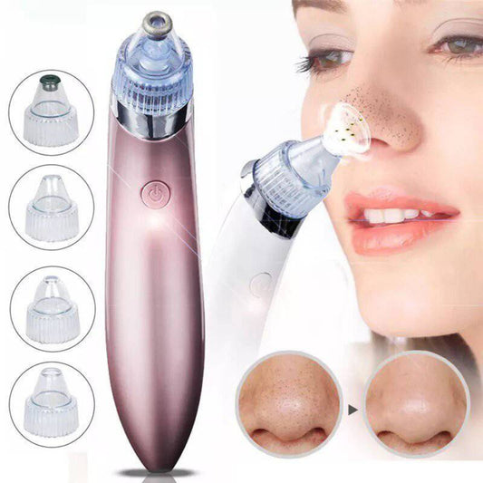 Limpiador Facial con Puntas de Diamantes. Di Adiós a las Espinillas y Luce Una Piel Suave y Radiante